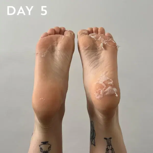 +maskology FOOT PEEL Professional Foot Treatment - Image 3